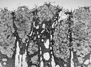 normal mucosa - stomach normal mucosa - stomach